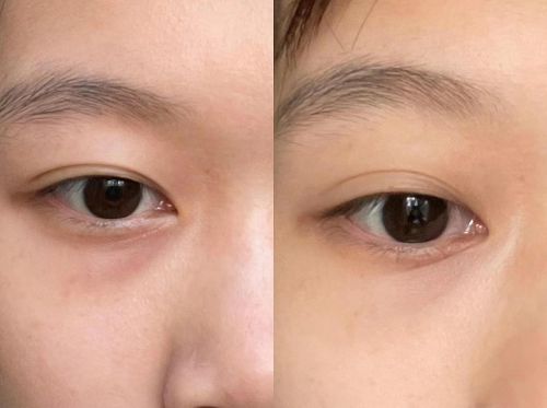 强！眼霜攻略分享十大淡纹排行推荐j9九游会登录抗皱眼霜排行榜前十(图7)